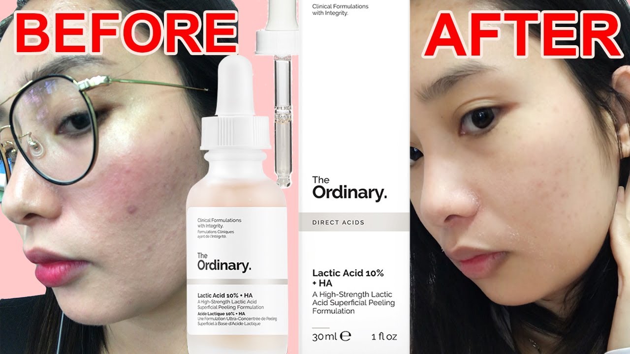 The Ordinary Lactic Acid 10 Ha Anwendung
